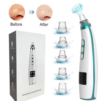 Electric Blackhead Remover Vacuum – Deep Pore Facial Cleanser Tool